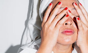 Common Skin Concerns: What’s Normal & When to See a Dermatologist