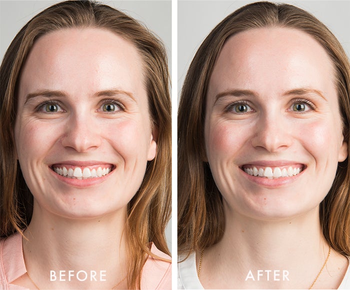 kat before after white duo kit I Dermstore Blog