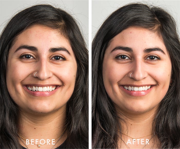 mel before after white duo kit I Dermstore Blog