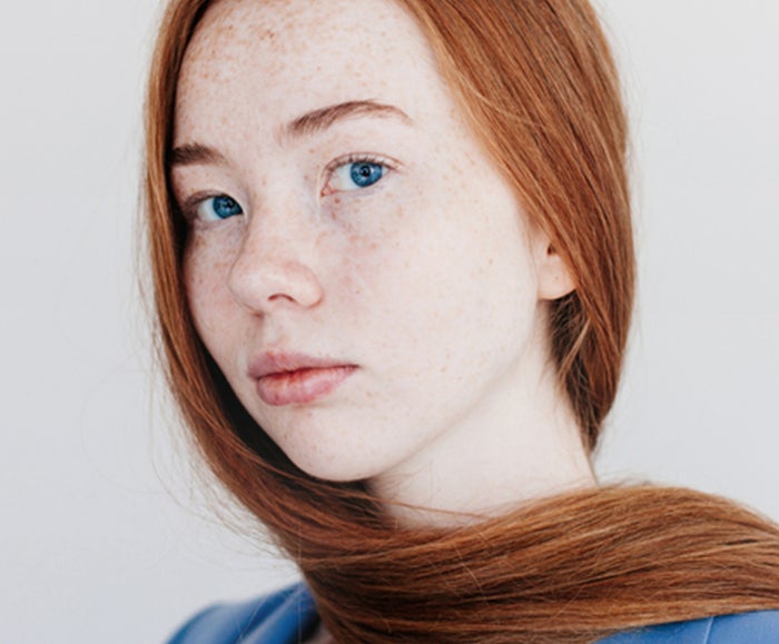 model with freckles