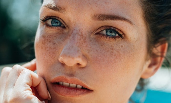 Woman with freckles outside in the sun
