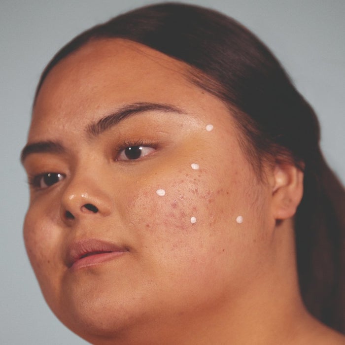 woman with spot cream