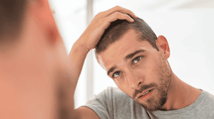 Male hair loss: what are my options?