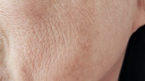 OXIDATIVE STRESS: THE SKIN’S NEMESIS