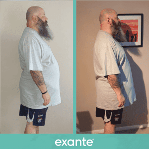 Tommy has lost weight following the exante 800 plan