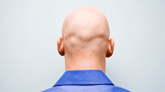 Back of bald man’s head 