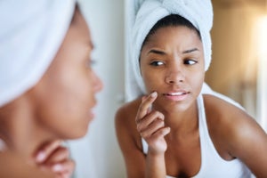 What Really Causes Acne? The 3 Main Culprits