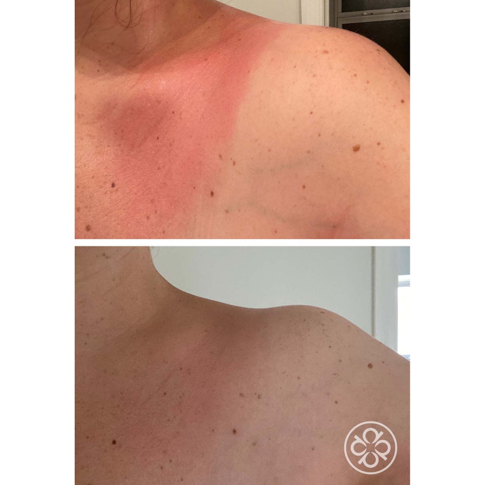 After-Sun Soothing Gel