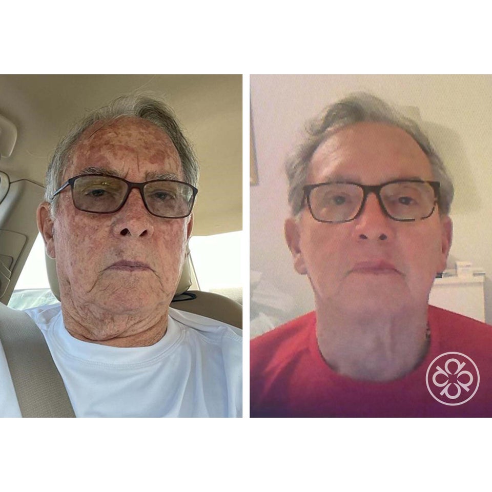 Lumafirm Repair Cream - Lift & Glow