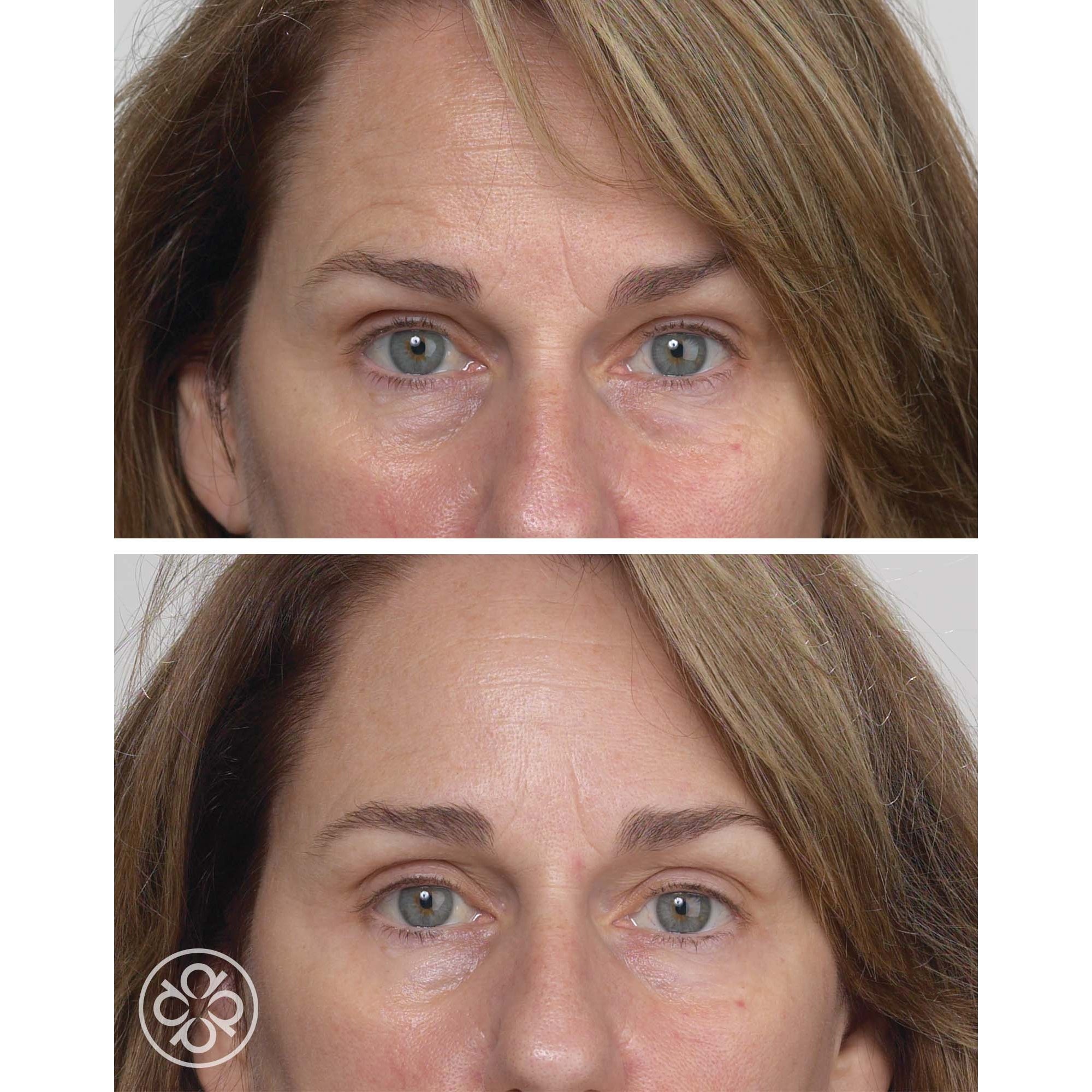 Stem Cells Phyto-Elite Intensive Serum | Pevonia US