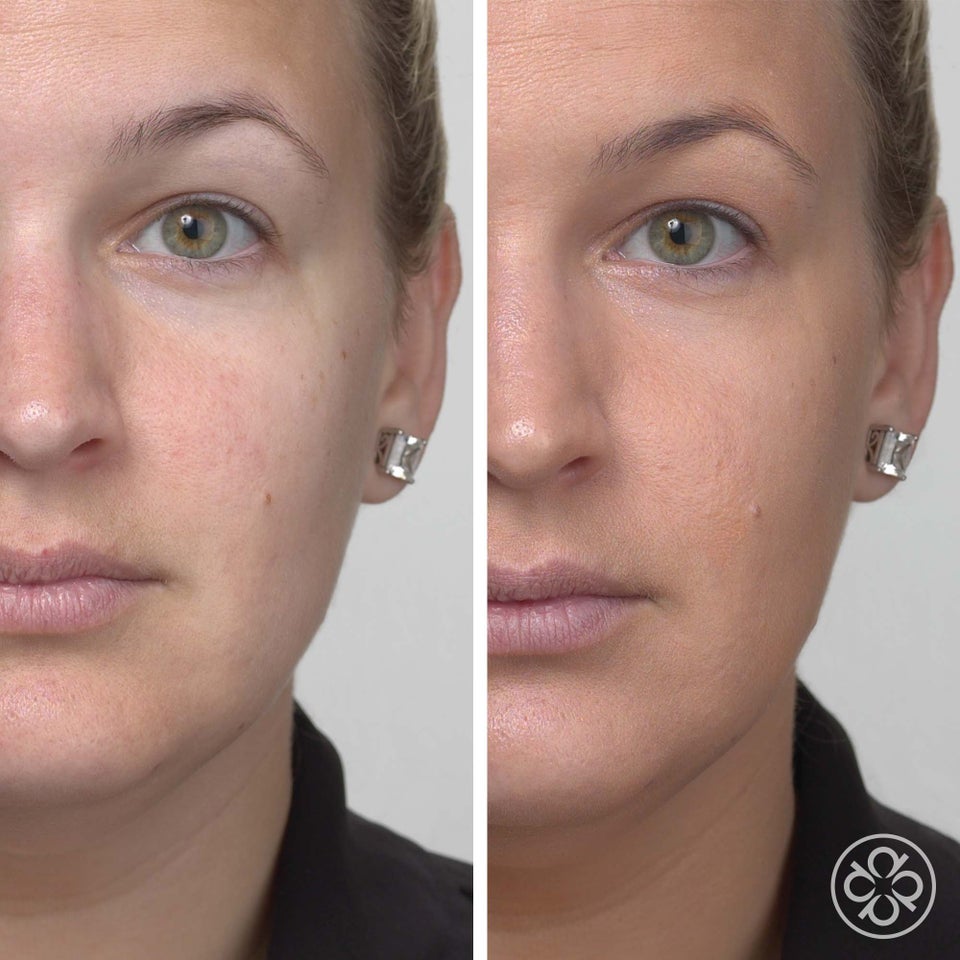 YouthRenew Tinted Cream