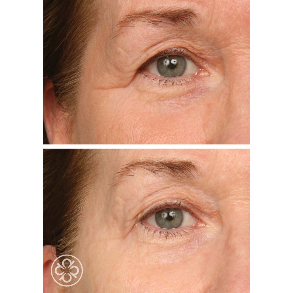 Lumafirm Eye Contour - Lift & Glow