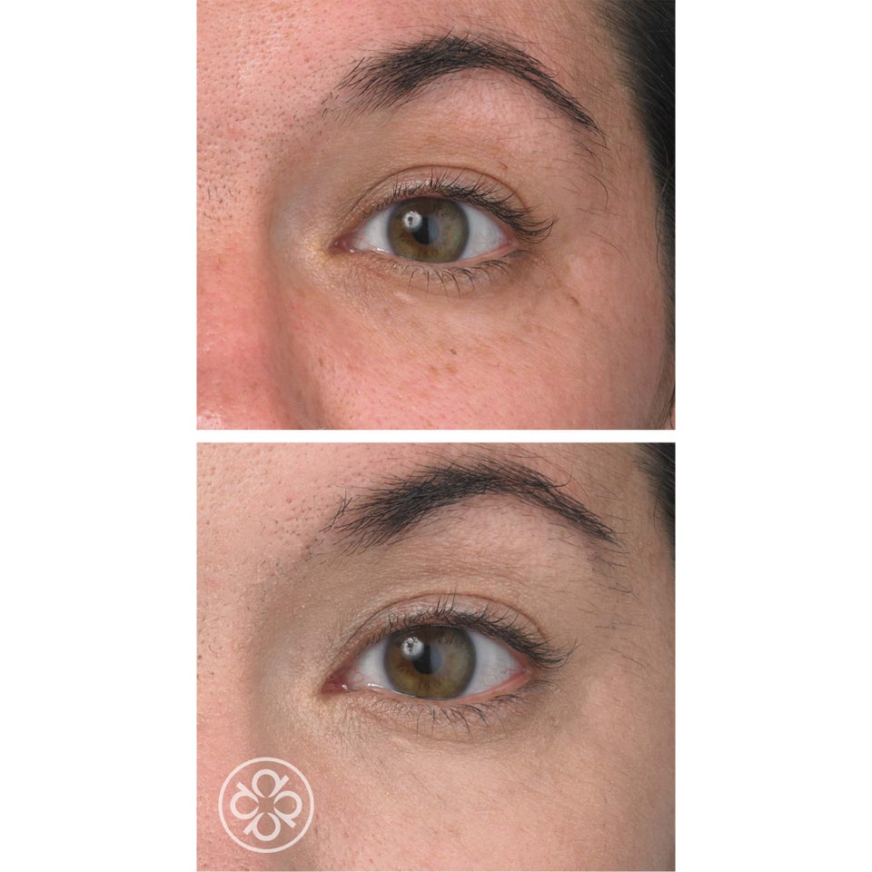 EyeRenew Conceal & De-Age