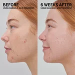 The INKEY List Mandelic Acid Treatment 15ml_5