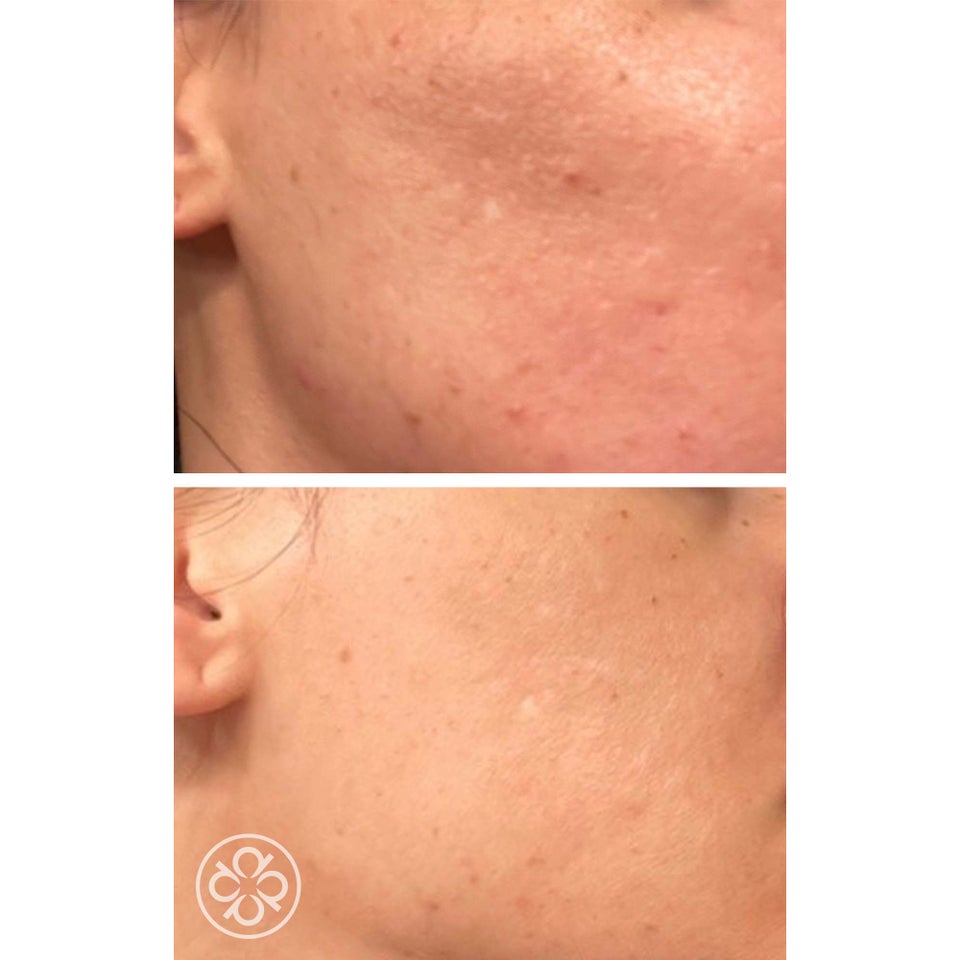 ProCorrective Clear-Control Moisturizer