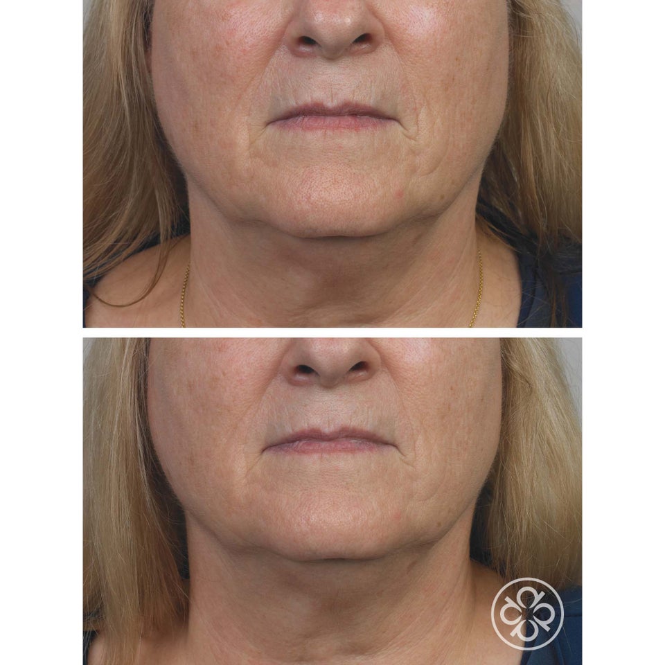 Micro-Retinol Essential Toner