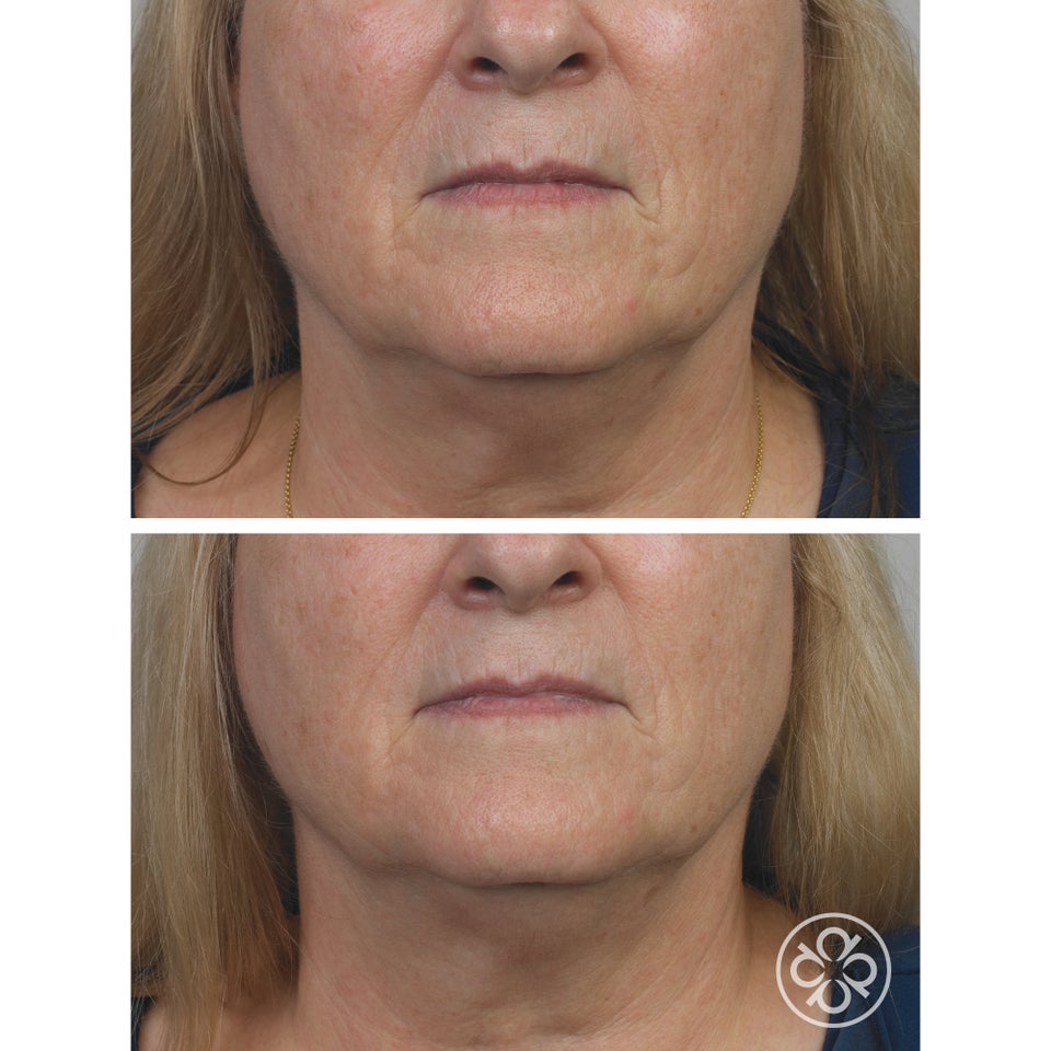 Micro-Retinol Essential Serum