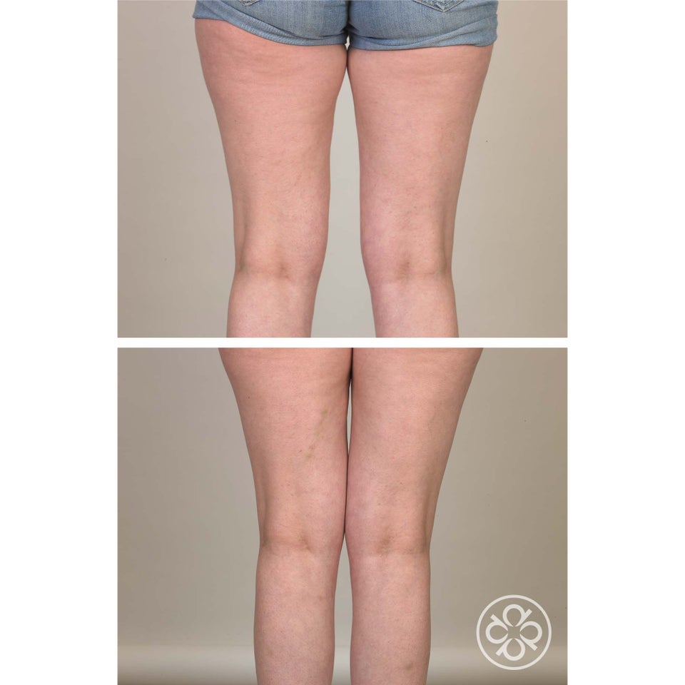 Crepe-No-More Body Cream