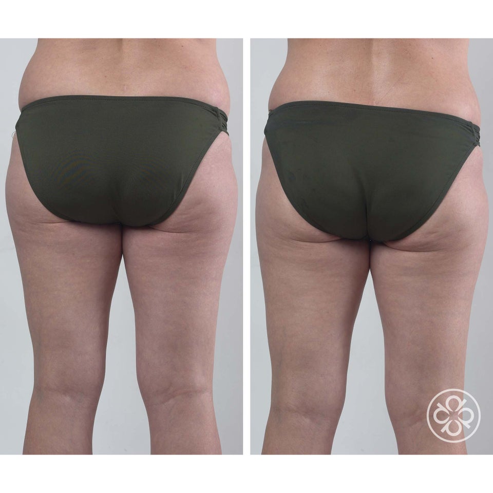 Lumafirm Body Moisturizer - Firm & Glow