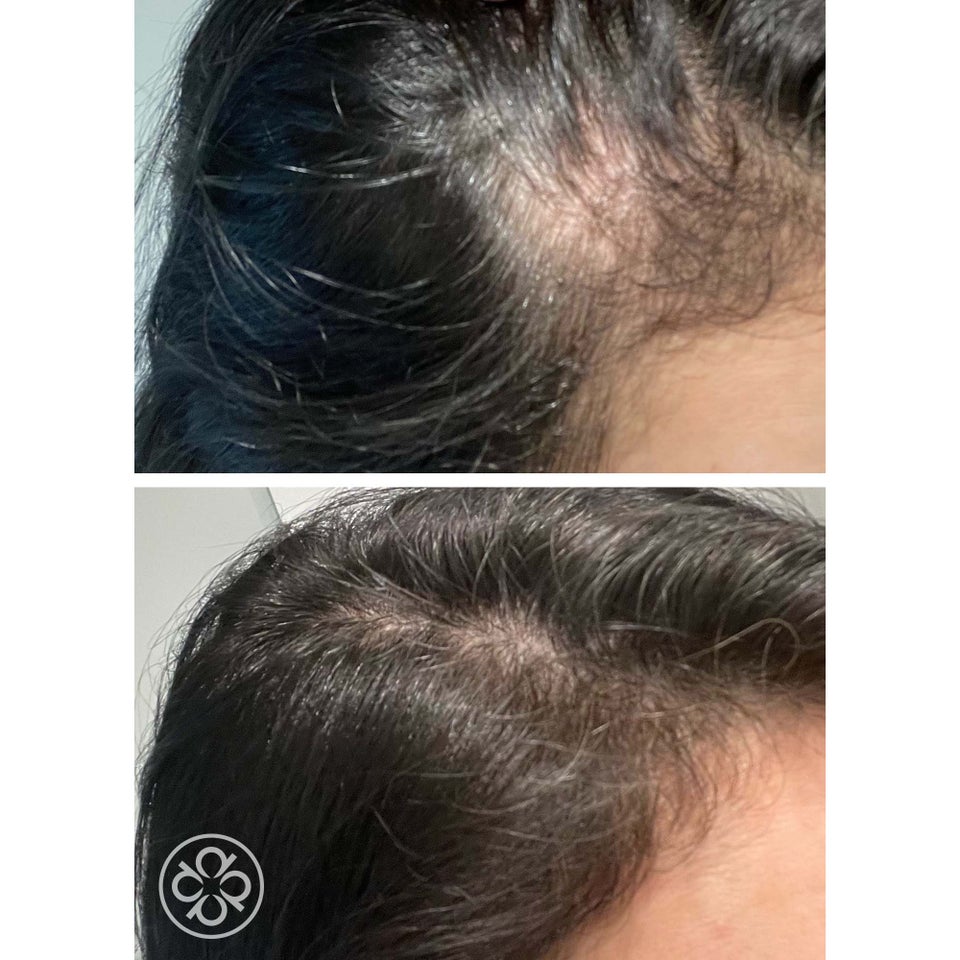 Hair Energize Extra-Strength Overnight Serum