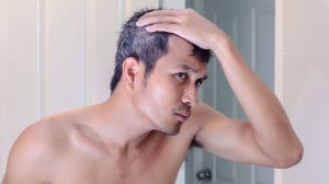 Mankind’s Guide to Handling Hair Loss