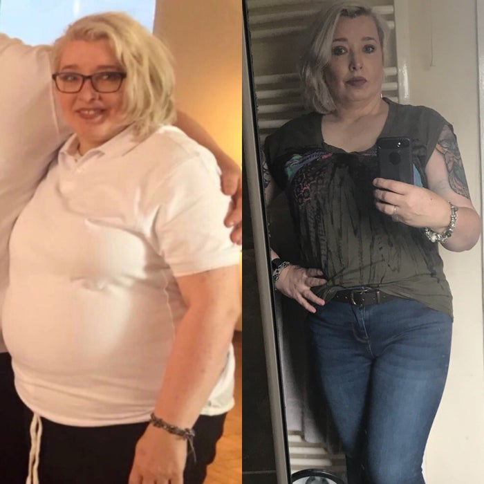 Vorher/Nacher Bild Tracey Diabetes Typ 2 Rückkehrung mit Exante