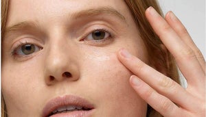 How To Treat Allergy-Prone Skin During Hay Fever Season