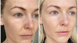 How to Get a Glowy Complexion – Tips from a Skin Specialist