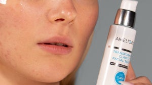 Dark Upper Lip? AMELIORATE’s guide on what to do