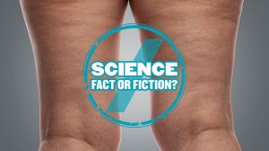 Je van Cellulitis ‘ontdoen’: Wetenschap of Fictie
