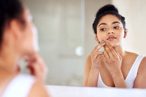 Pimples, Blackheads, & Whiteheads: What’s The Difference?