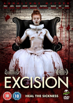 Excision