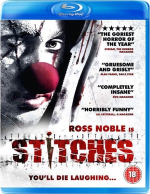 Stitches