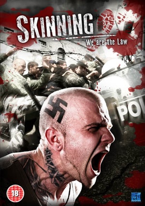 Skinning: We are the Law