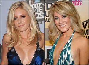 Heidi Montag’s Surgery Shock