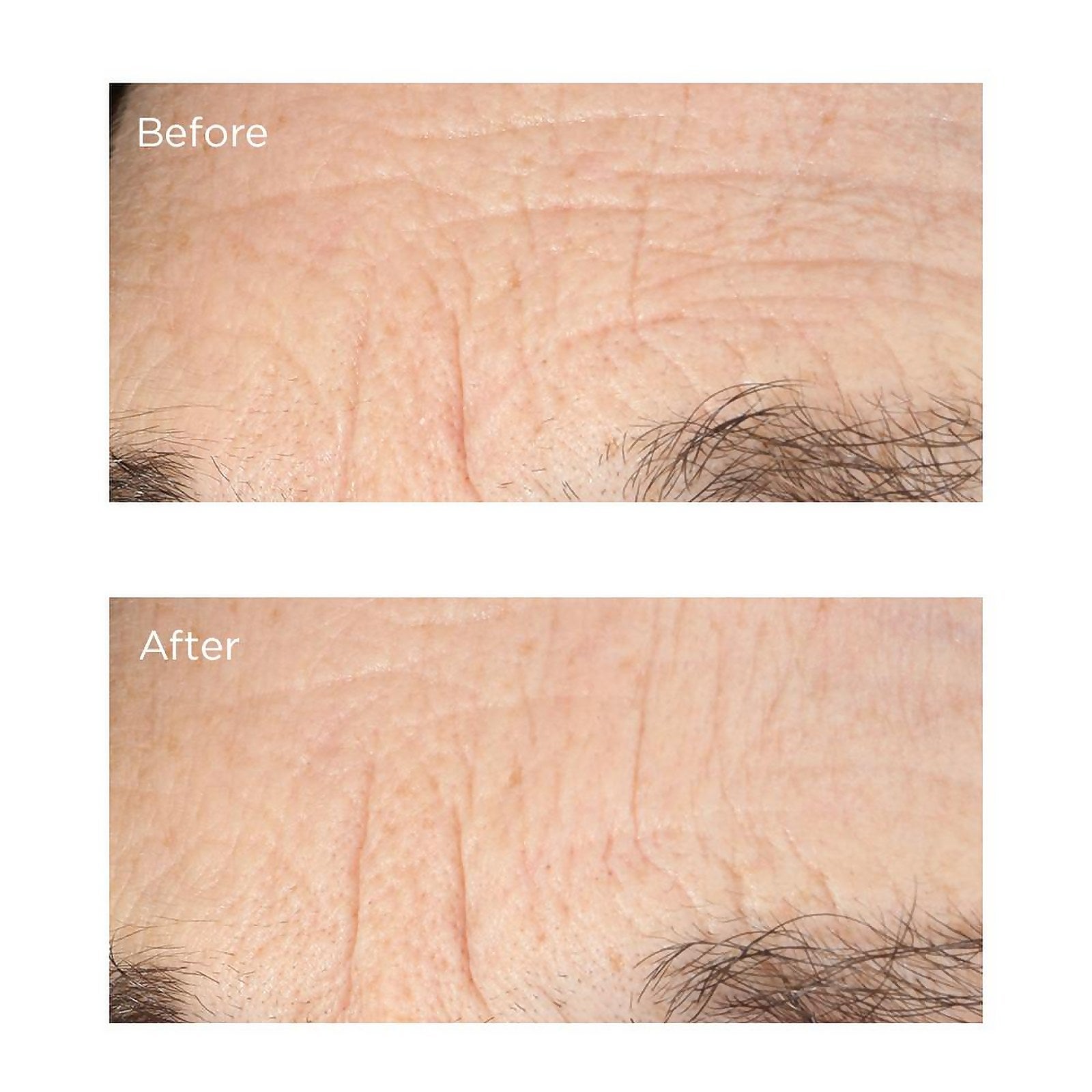 perricone md acyl glutathione deep crease serum reviews Essential Fx Acyl-Glutathione - Outlet as this alluring scent Therapeutic Pack Size:30 days pack ghk-cu tachyphylaxis or tolerance