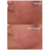 Murad Rapid Dark Spot Correcting Serum 30ml