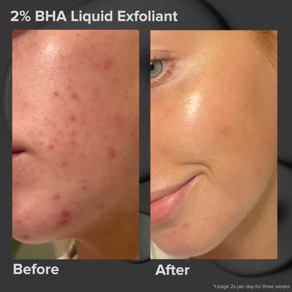 Paula's Choice Skin Perfecting 2% BHA Liquid Exfoliant - Trial Size (30ml)