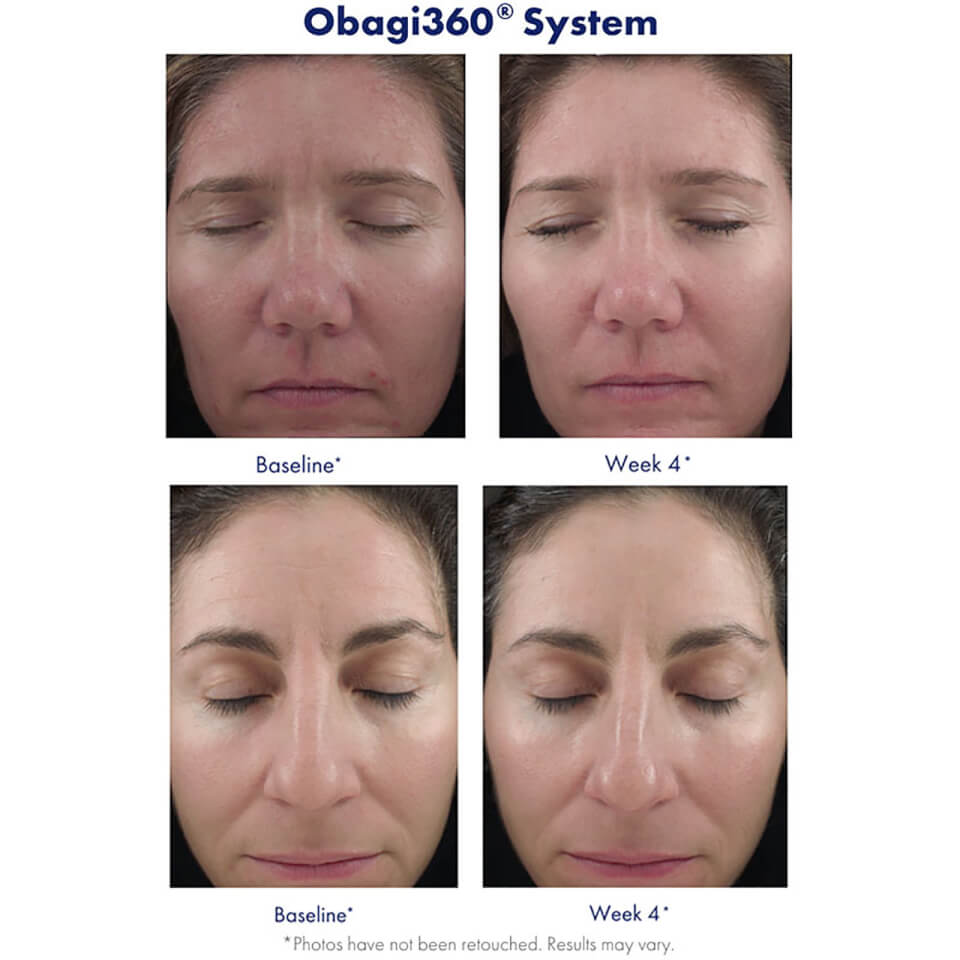 Obagi Medical360 Retinol 1.0