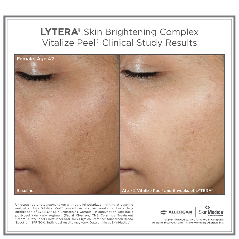 SkinMedica LYTERA Skin Brightening Complex