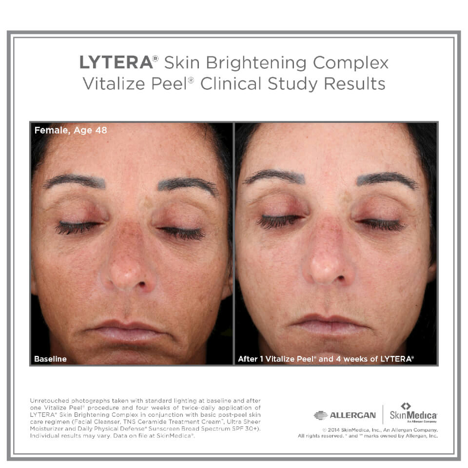 SkinMedica LYTERA Skin Brightening Complex
