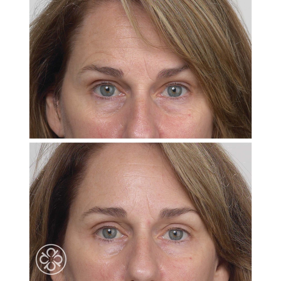 Stem Cells Phyto-Elite Intensive Cream