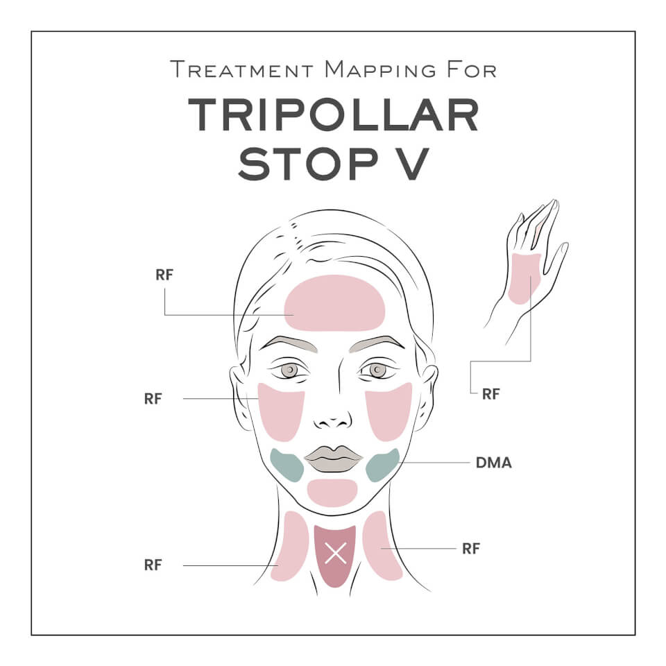 TriPollar STOP V Facial Reshaping & Rejuvenation Device- Navy