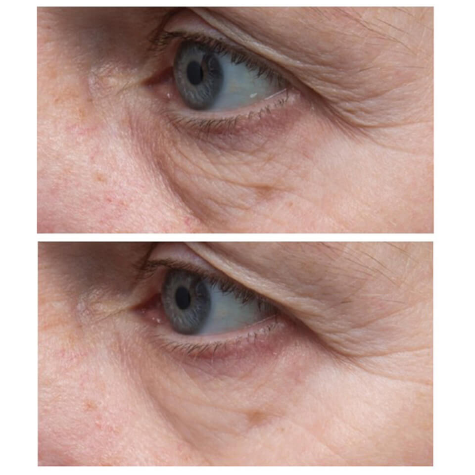 Dr Dennis Gross Skincare C+Collagen Brighten and Firm Eye Cream 15ml