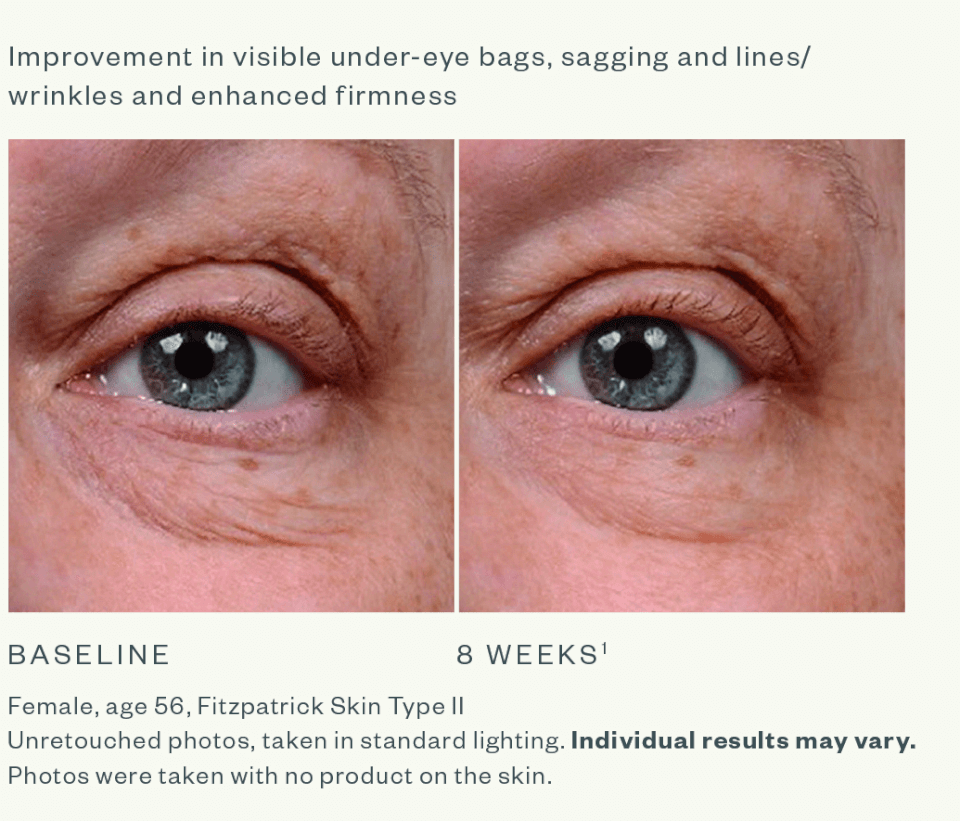 SkinMedica Instant Bright Eye Cream 5 oz