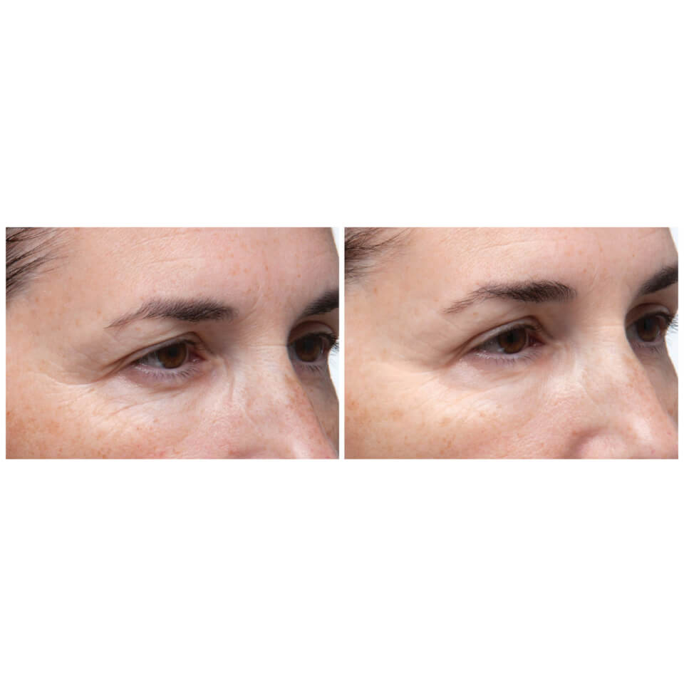 Dr Dennis Gross Skincare Ferulic + Retinol Triple Correction Eye Serum