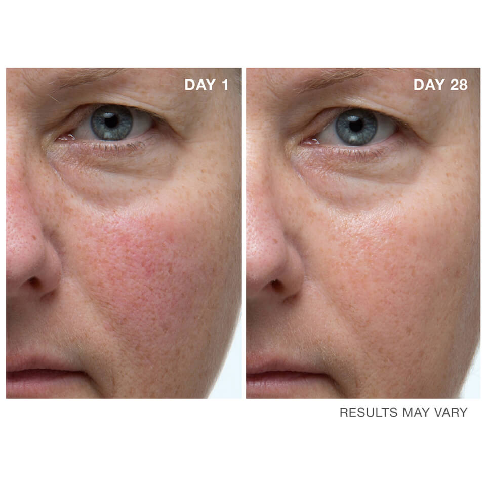 Dr Dennis Gross Skincare Ferulic + Retinol Wrinkle Recovery Overnight Serum