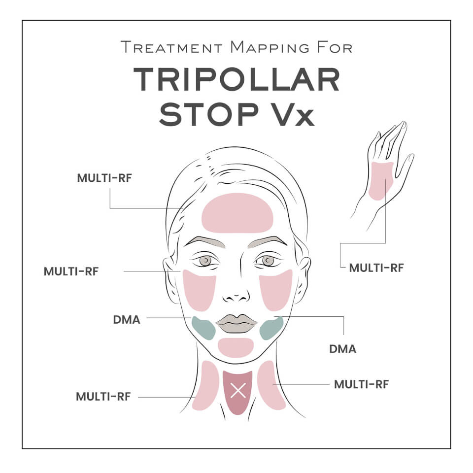 TriPollar STOP Vx Facial Renewal, Reshaping & Rejuvenation Device