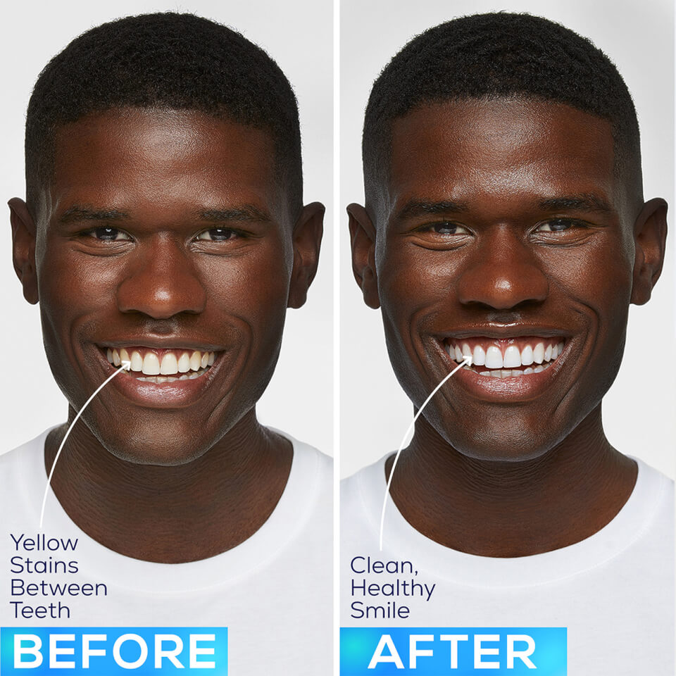 GLO Science GLO Lit Teeth Whitening GLO Vials - 3 GLO Vials