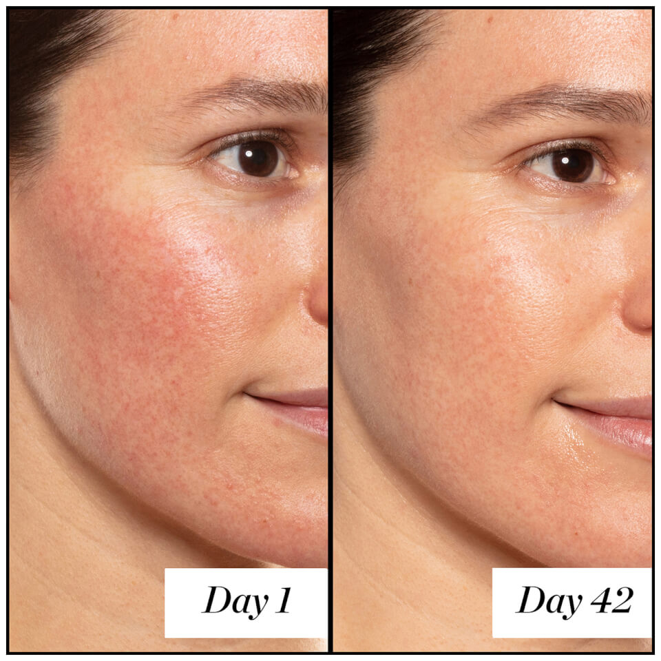 Sunday riley deals retinol